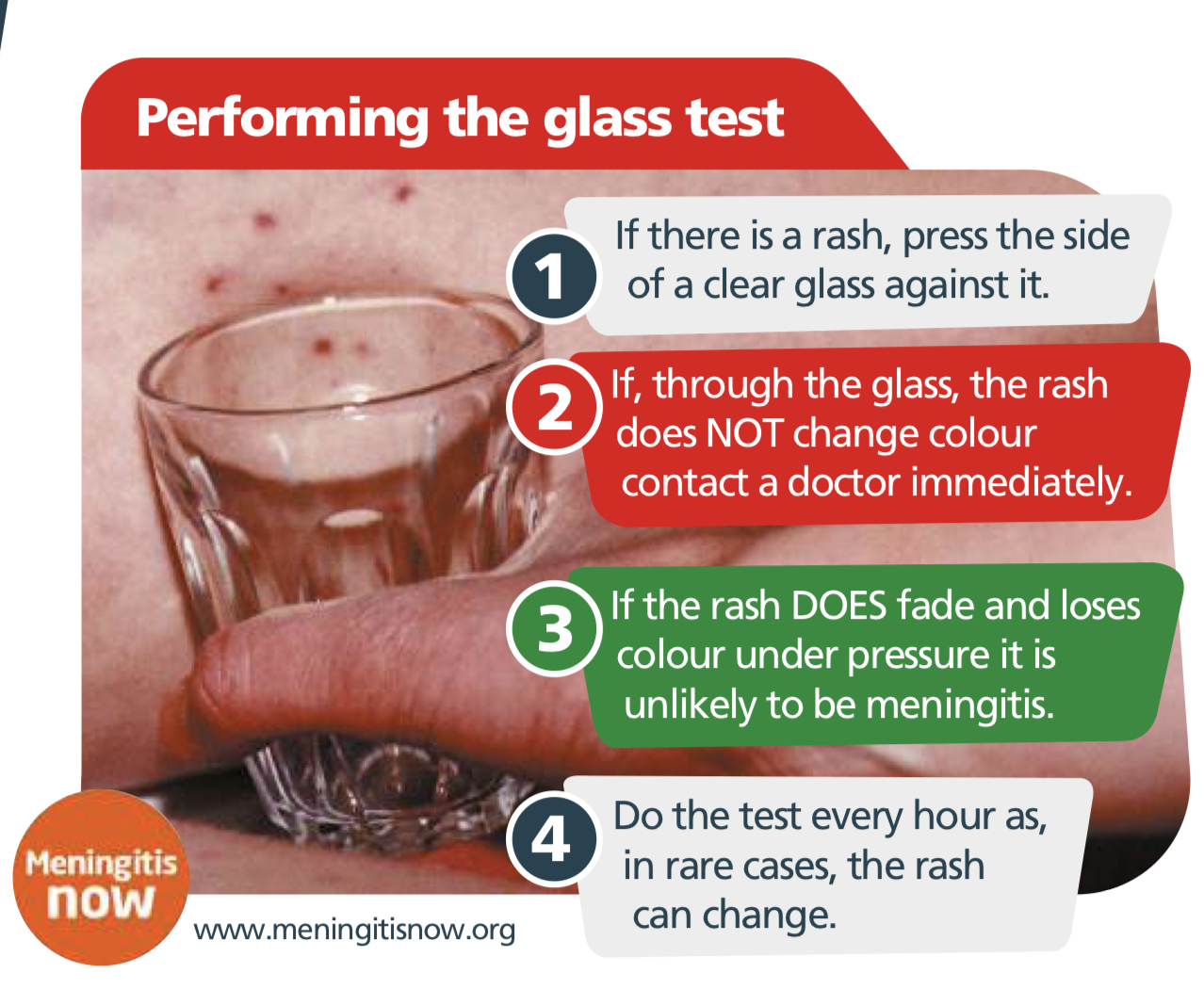 Meningitis glass test.png