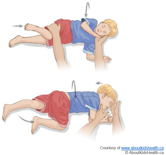 A cartoon of a child being moved into the recovery position following a seizure